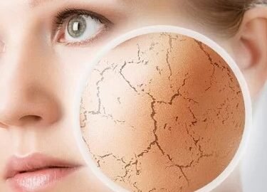 como melhorar a pele do rosto