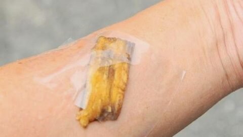 casca de banana tira verruga